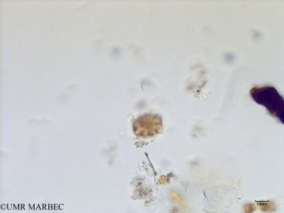 Cerataulus granulatus (Species)